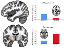 Liberal and Conservative Brains